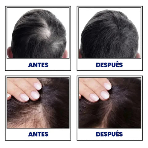 Fibra Capilar - Cabello al instante en segundos
