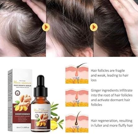 GingerGlow: ¡Despierta tu melena con el poder del jengibre natural! 🌱