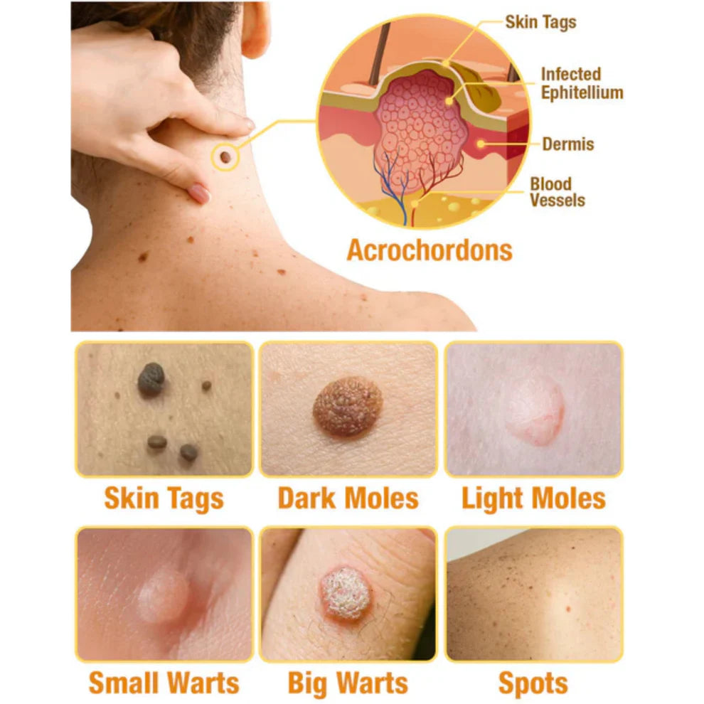 ✨BeeSkin Pro™ – La solución experta con el toque mágico de la abeja