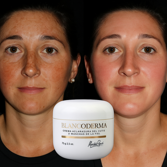 Crema Blanqueadora de Cutis y Manchas - Blancoderma