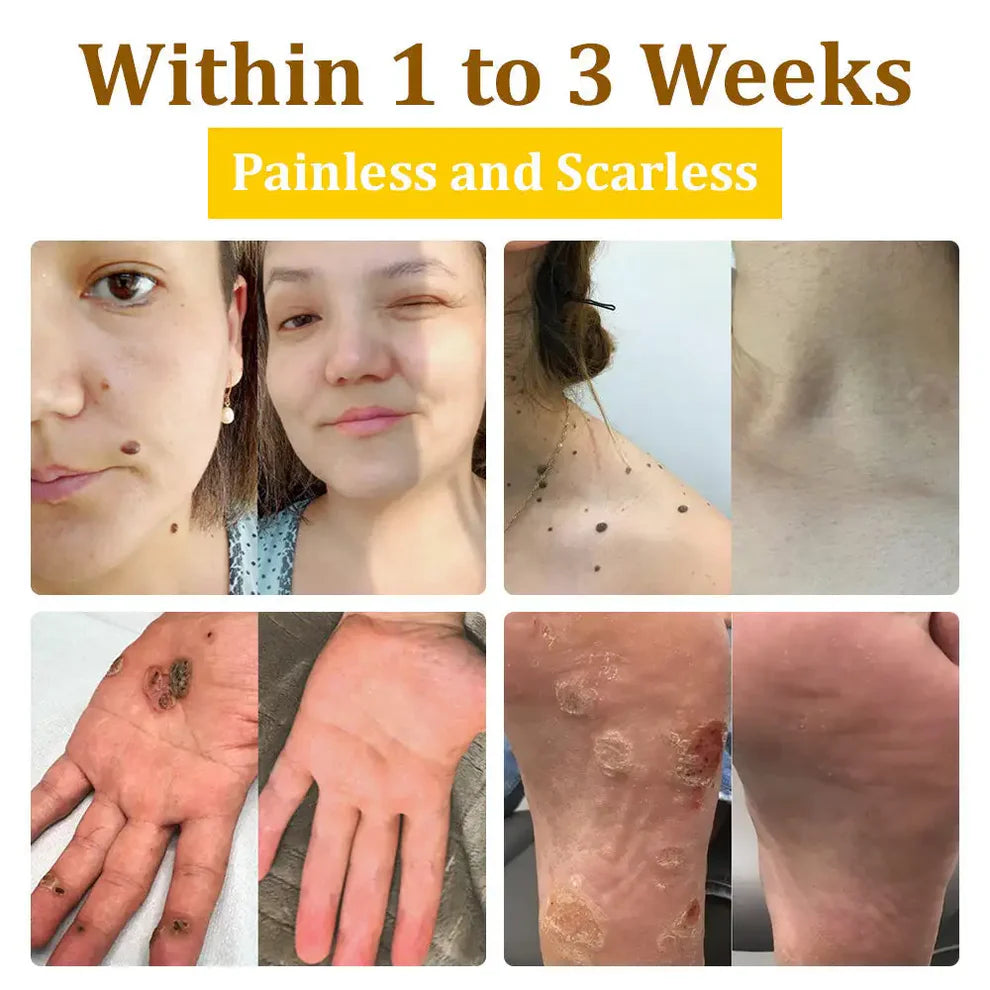 ✨BeeSkin Pro™ – La solución experta con el toque mágico de la abeja
