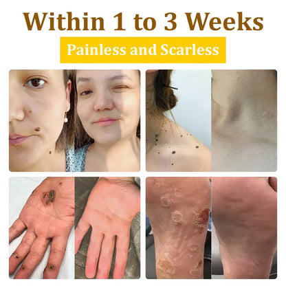 ✨BeeSkin Pro™ – La solución experta con el toque mágico de la abeja