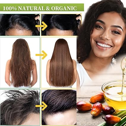 Aceite de batana para el crecimiento del cabello, aceite natural puro para el cabello , anti pérdida de cabello, evita que el cabello elimine las puntas abiertas para hombres y mujeres, 4.05 onzas líquidas