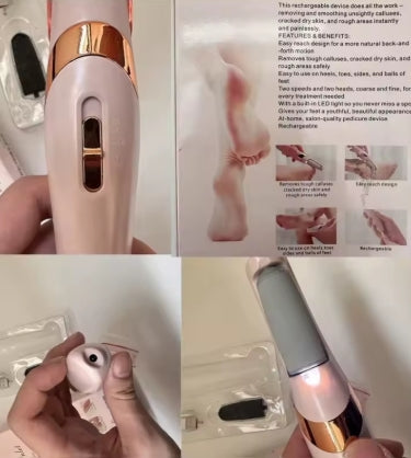 Eliminador de Callos de Piel Muerta Para Pies, Máquina de Belleza de Pies Recargable, Pedicura
