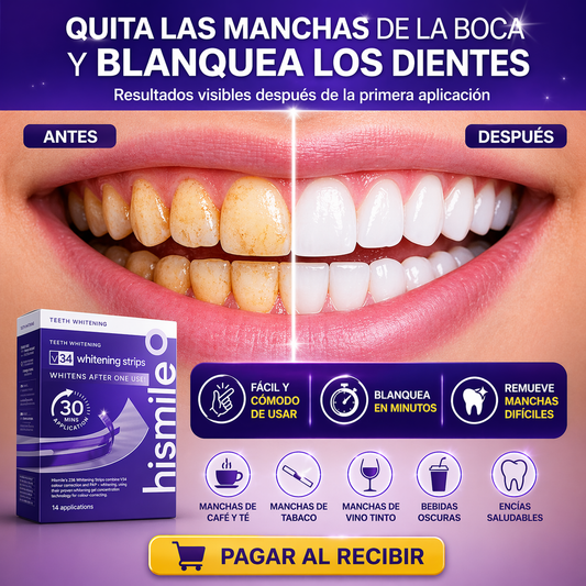Hismile V34 Whitening Strips- Tiras blanqueadoras dentales