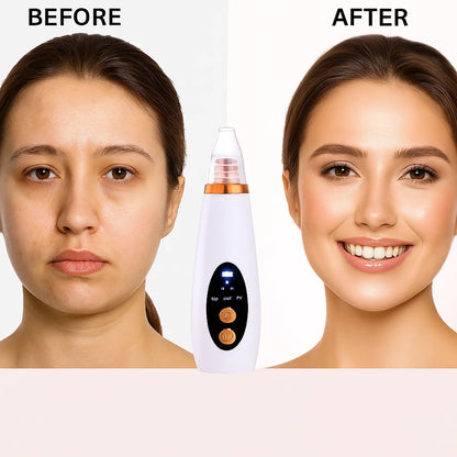 CleanGlow™:🧖‍♀️💗 Tu nuevo ritual de belleza desde casa