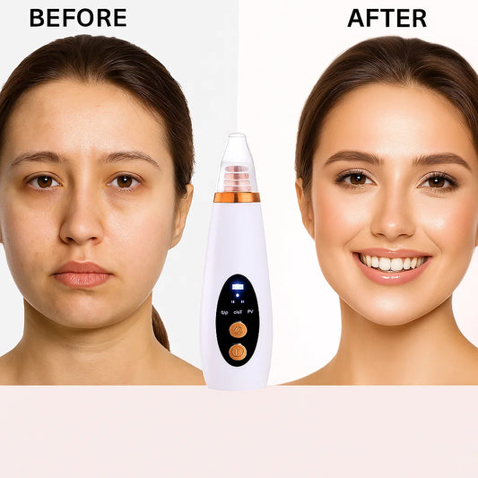 CleanGlow™:🧖‍♀️💗 Tu nuevo ritual de belleza desde casa