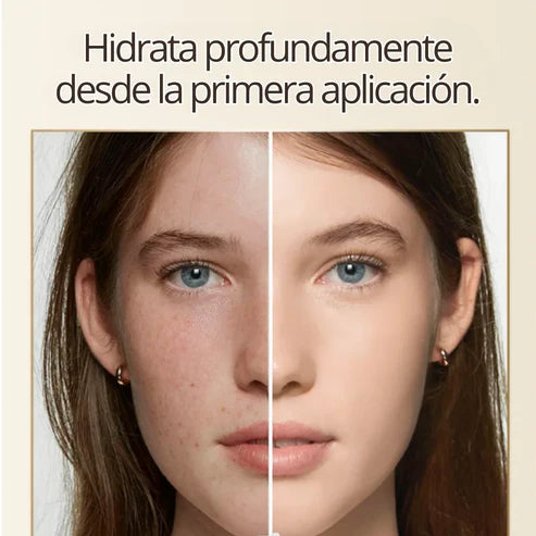 Crema Blanqueadora de Cutis y Manchas - Blancoderma