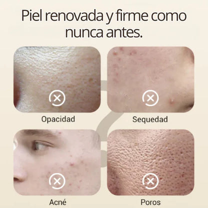 Crema Blanqueadora de Cutis y Manchas - Blancoderma