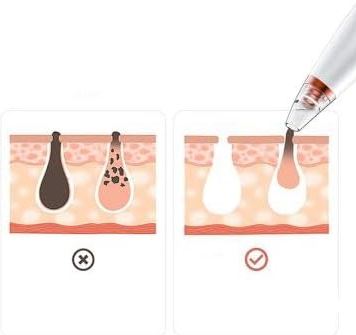 CleanGlow™:🧖‍♀️💗 Tu nuevo ritual de belleza desde casa