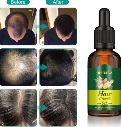 RenaceCapilar Activa tus folículos y haz que tu cabello vuelva a crecer naturalmente. 🌱