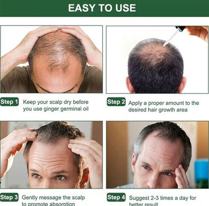 RenaceCapilar Activa tus folículos y haz que tu cabello vuelva a crecer naturalmente. 🌱