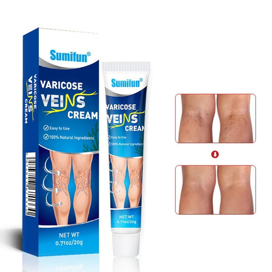Crema Para Aliviar Varices